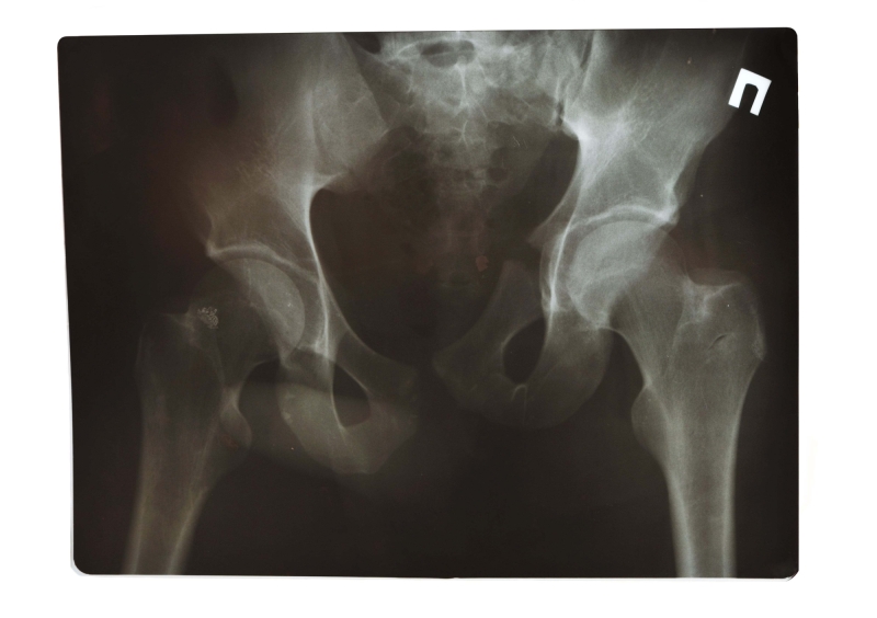 X ray shot 2024 10 11 05 27 27 utc min